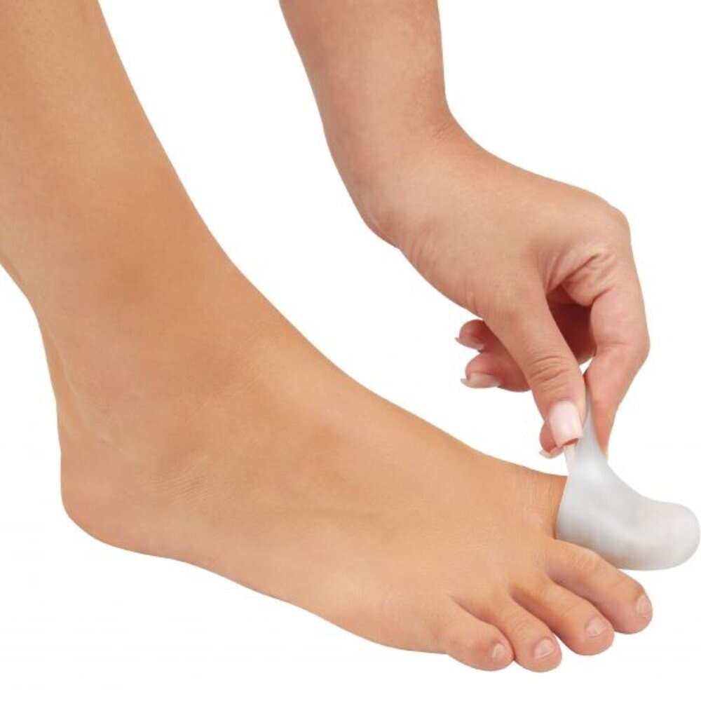 Protetor para Unhas Encravadas Skingel - Ortho Pauher 1 Protetor para Unhas Encravadas Skingel - Ortho Pauher