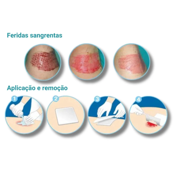 Curativo Alginato de Cálcio e Sódio - Curatec 6 Curativo Alginato de Cálcio e Sódio - Curatec – imagem 6 de 6