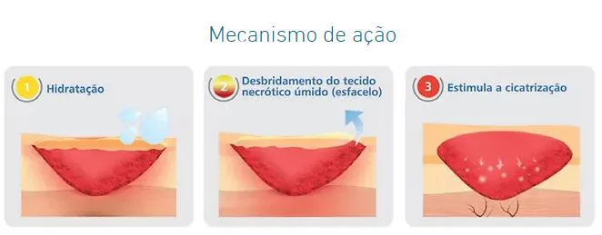 Hidrogel Estéril com AGE para Cicatrização - Curatec 2 Hidrogel Estéril com AGE para Cicatrização - Curatec – imagem 2 de 3